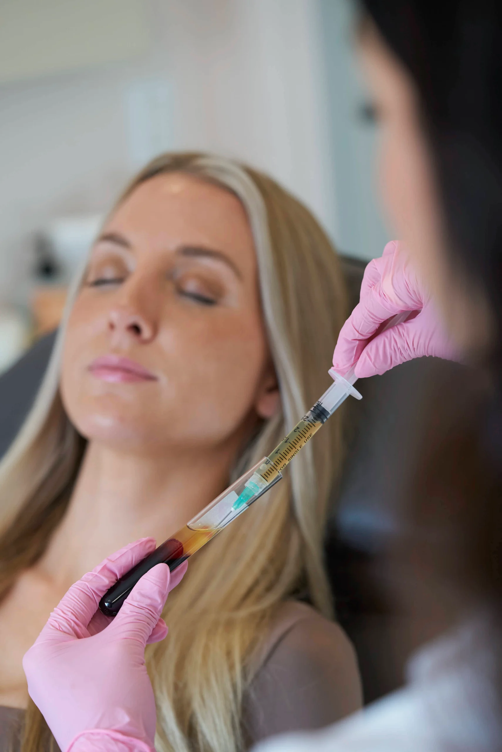 prf-microneedling-in-costa-mesa-ca