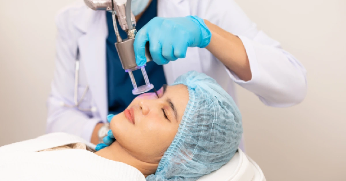 Women Receiving CoolPeel treatment in Costa Mesa, CA