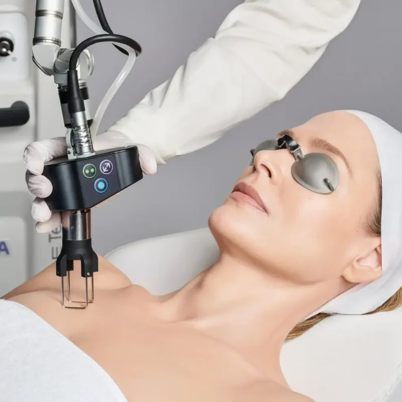 CoolPeel CO2 laser in Costa Mesa CA GLO Bar MedSpa