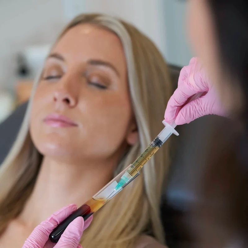 prf-microneedling-in-costa-mesa-ca (1)